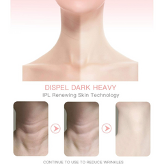 High Frequency Vibration Skin Rejuvenation Device, Face & Neck Wrinkle Remover High Frequency Vibration Skin Rejuvenation Device, Face & Neck Wrinkle Remover