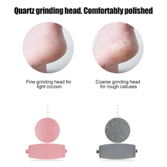Callus Remover, Portable Electric Pedicure Tool for Soft Feet