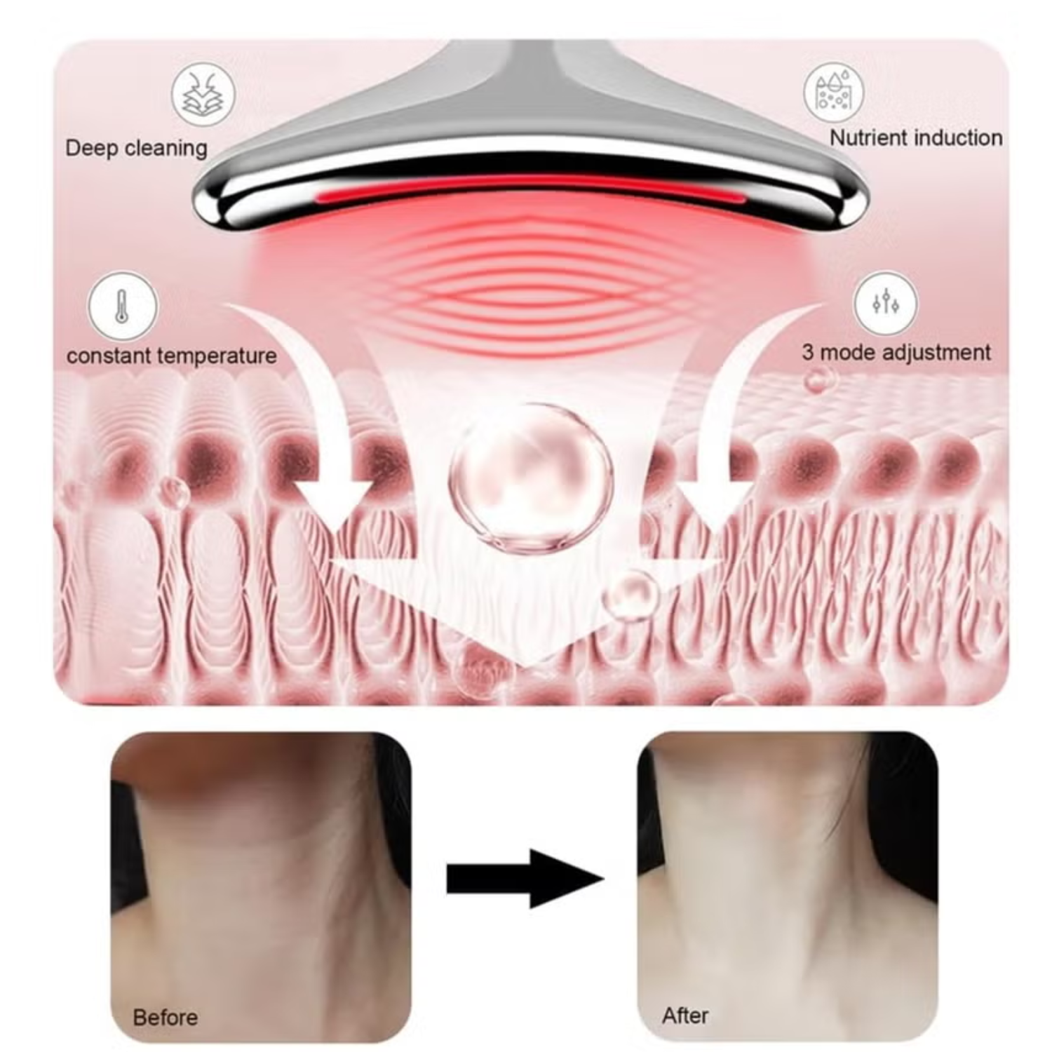 High Frequency Vibration Skin Rejuvenation Device, Face n Neck Wrinkle Remover