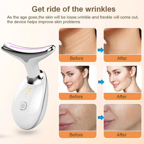 High Frequency Vibration Skin Rejuvenation Device, Face & Neck Wrinkle Remover